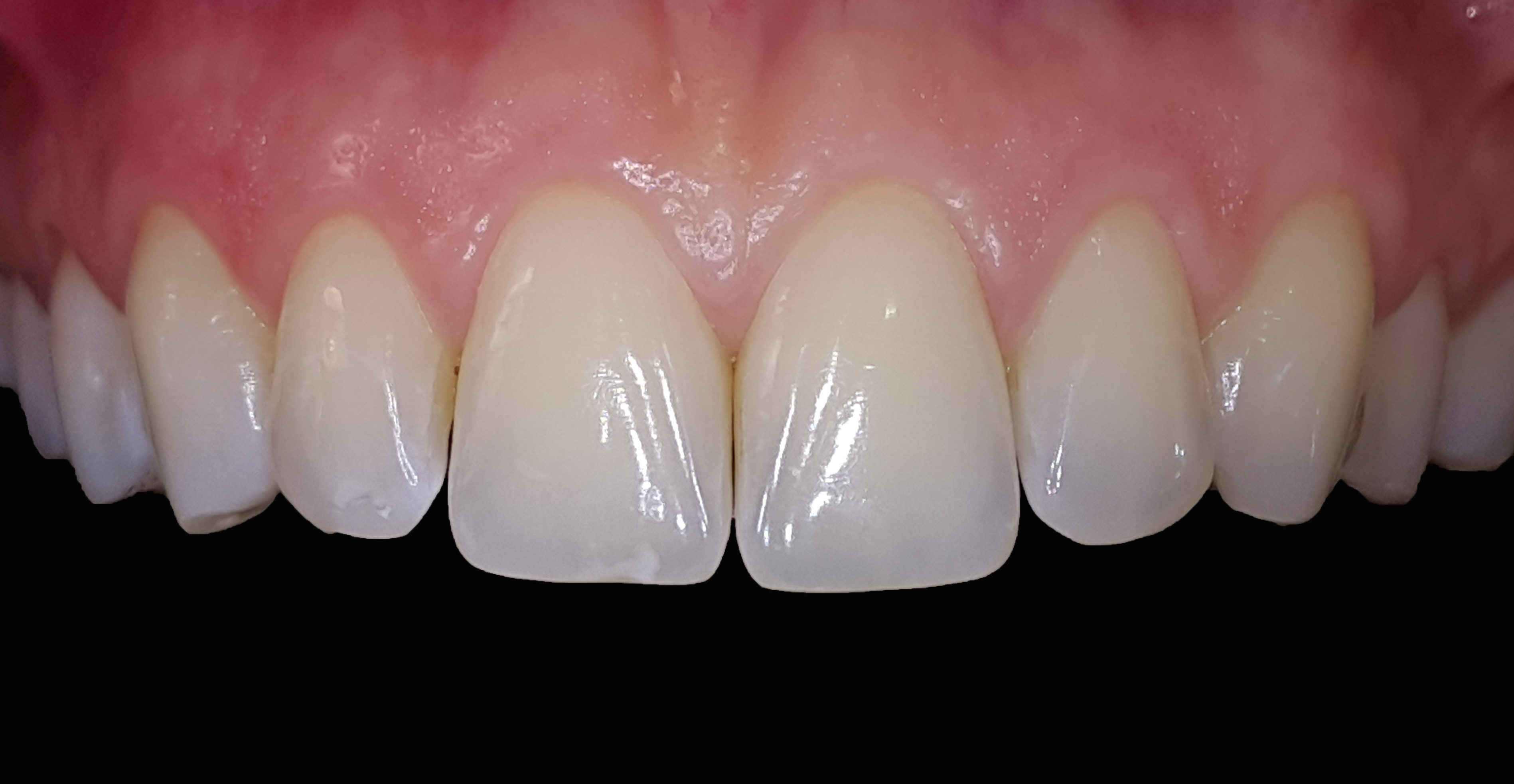 Farbaufnahme, Fotografie Farbaufnahme, Fotografie