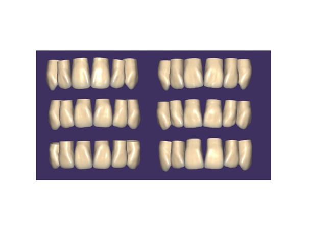 xCAD Tooth Library